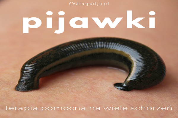 Pijawki