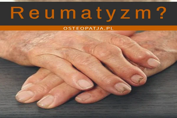 Reumatyzm – czy jesteście pewni, że wiecie co to za choroba?